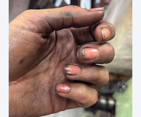 Vieze handen, maar één van de gaafste dingen die Josine heeft gedaan.